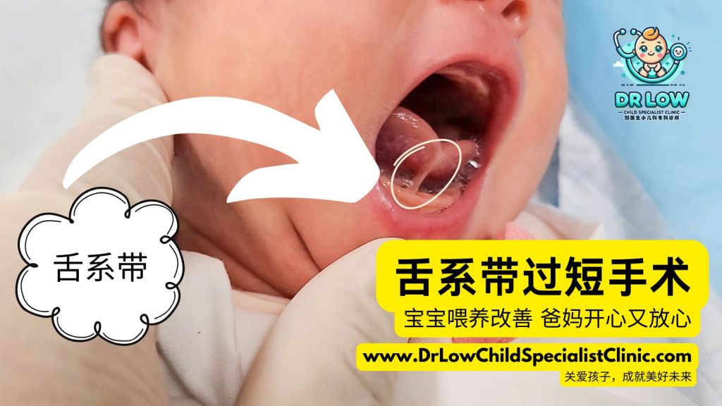 舌系带过短手术顺利完成 在峇株巴辖班台医院 - 峇株吧辖刘医生小儿科专科诊所 - 宝宝喂养改善 爸妈开心又放心 01