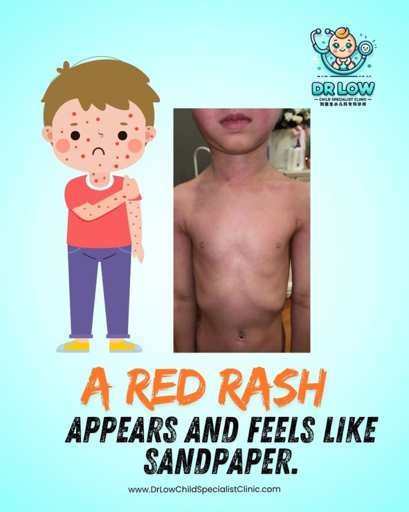 Demam Scarlet pada Kanak-Kanak - Simptom dan Rawatan dan Bila Perlu Jumpa Doktor - Klinik Pakar Kanak-kanak Batu Pahat Dr Low 04