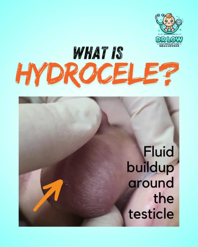 Hydrocele Kanak-Kanak Ibu Bapa di Batu Pahat Perlu Tahu - Klinik Pakar Kanak-kanak Dr Low Batu Pahat 02