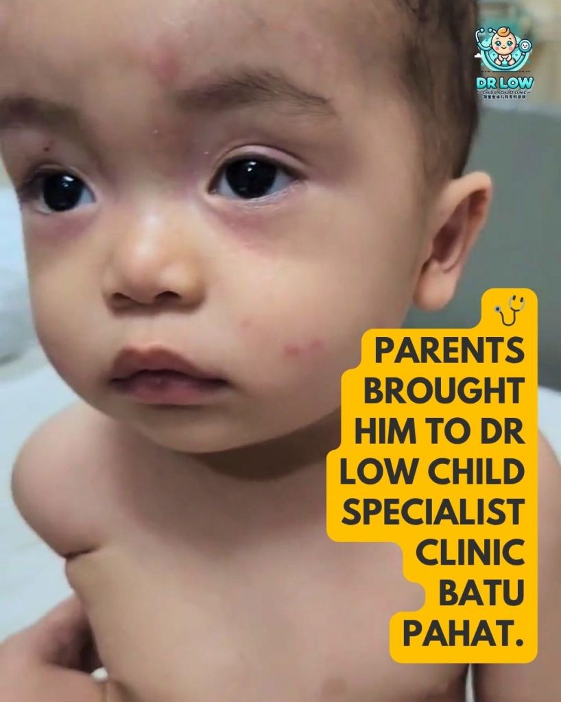 rawatan kulit bayi sebelum selepas batu pahat 03