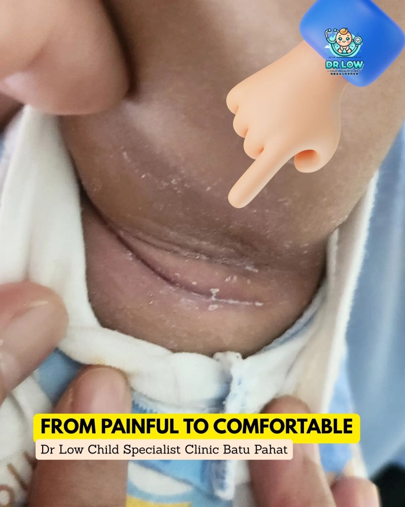 Successful Recovery from Atopic Dermatitis with Skin Infection in Batu Pahat - Dr Low Child Specialist Clinic BP 06