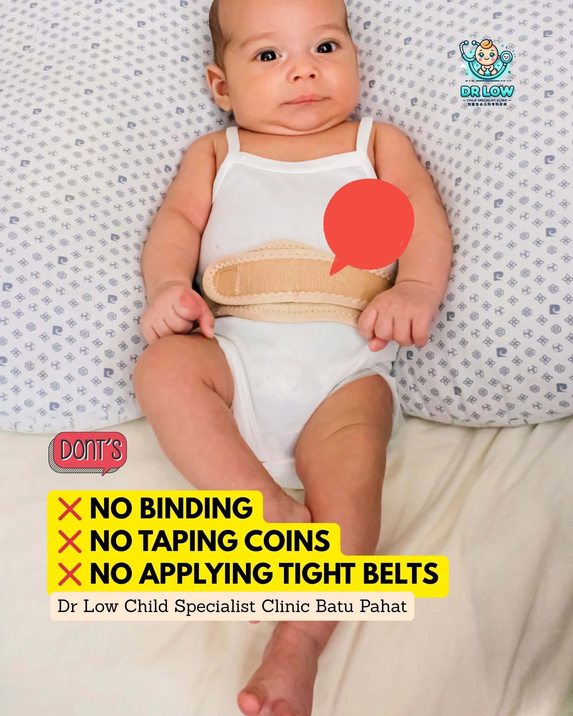 Umbilical Hernia in Babies - Diagnosis Care and Recovery at Dr Low Child Specialist Clinic Batu Pahat Klinik Pakar Kanak-kanak BP 06