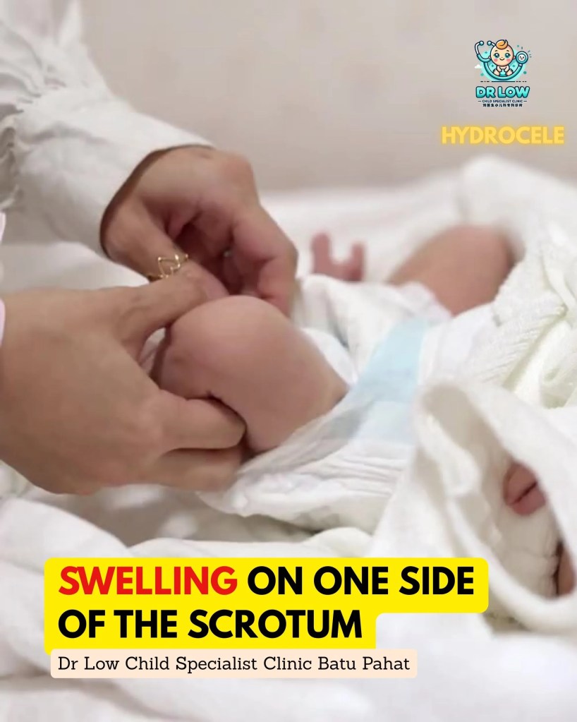 Hydrocele in Newborn Boys Batu Pahat – Diagnosis, Monitoring and Recovery at Dr Low Child Specialist Clinic Batu Pahat Johor Malaysia - Paediatrician BP 03