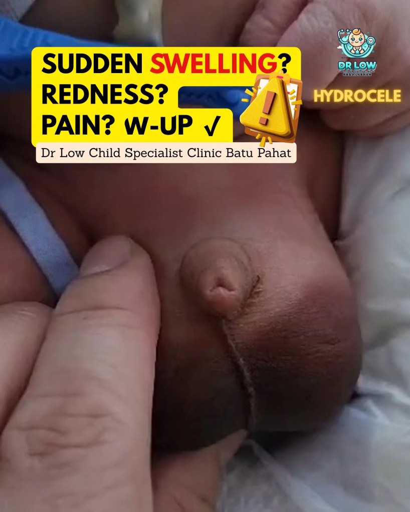 Hydrocele in Newborn Boys Batu Pahat – Diagnosis, Monitoring and Recovery at Dr Low Child Specialist Clinic Batu Pahat Johor Malaysia - Paediatrician BP 07
