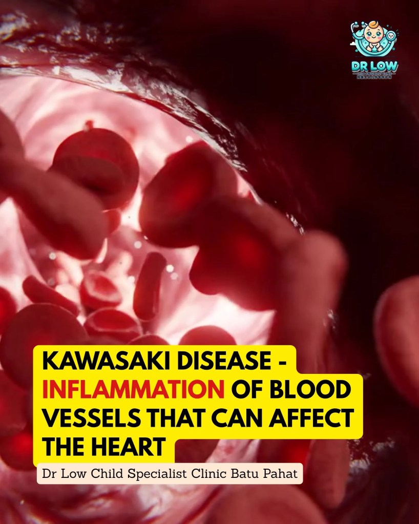 Kawasaki Disease in Children – Early Signs, Treatment and Recovery | Dr Low Child Specialist Clinic Batu&nbsp;Pahat