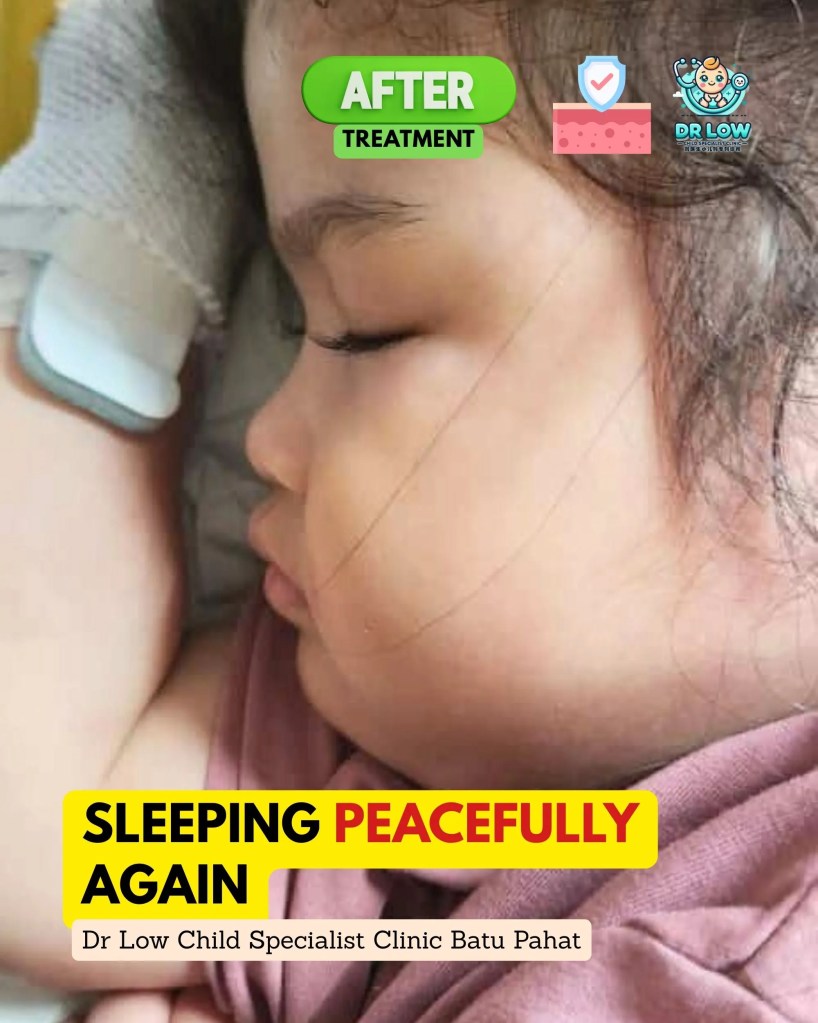 Severe Atopic Dermatitis with Skin Infection in Batu Pahat Johor Malaysia – A Child’s Recovery Journey at Dr Low Child Specialist Clinic Batu Pahat BP 08