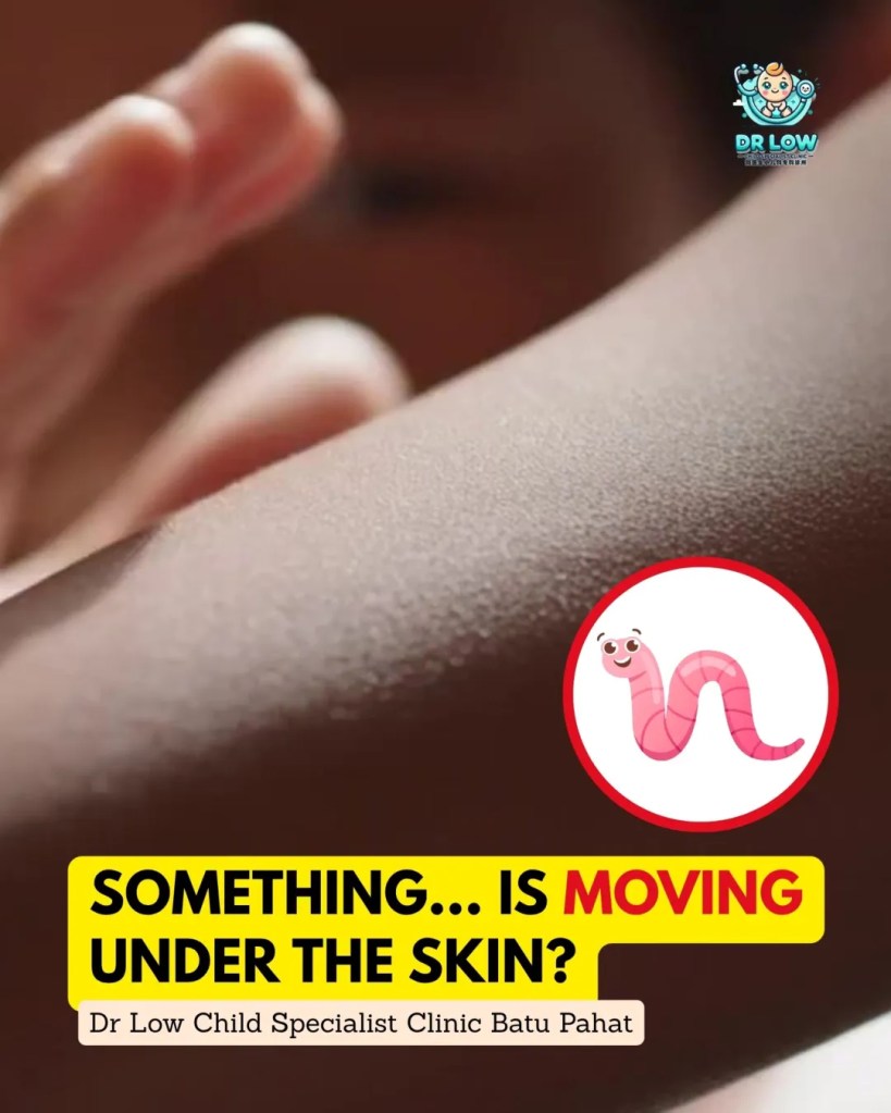 Creeping Skin Rash in Children BP - Cutaneous Larva Migrans in Batu Pahat - From Diagnosis to Recovery on Child Specialist Clinic Batu Pahat Dr Low 02
