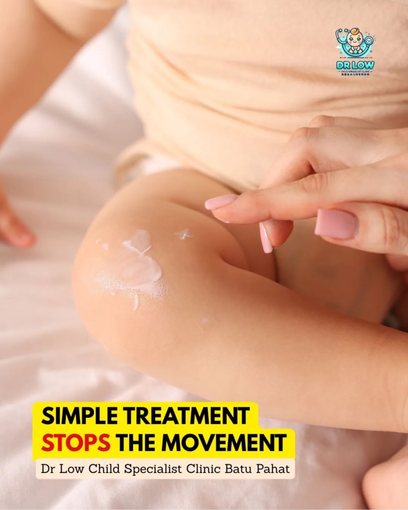 Creeping Skin Rash in Children BP - Cutaneous Larva Migrans in Batu Pahat - From Diagnosis to Recovery on Child Specialist Clinic Batu Pahat Dr Low 08