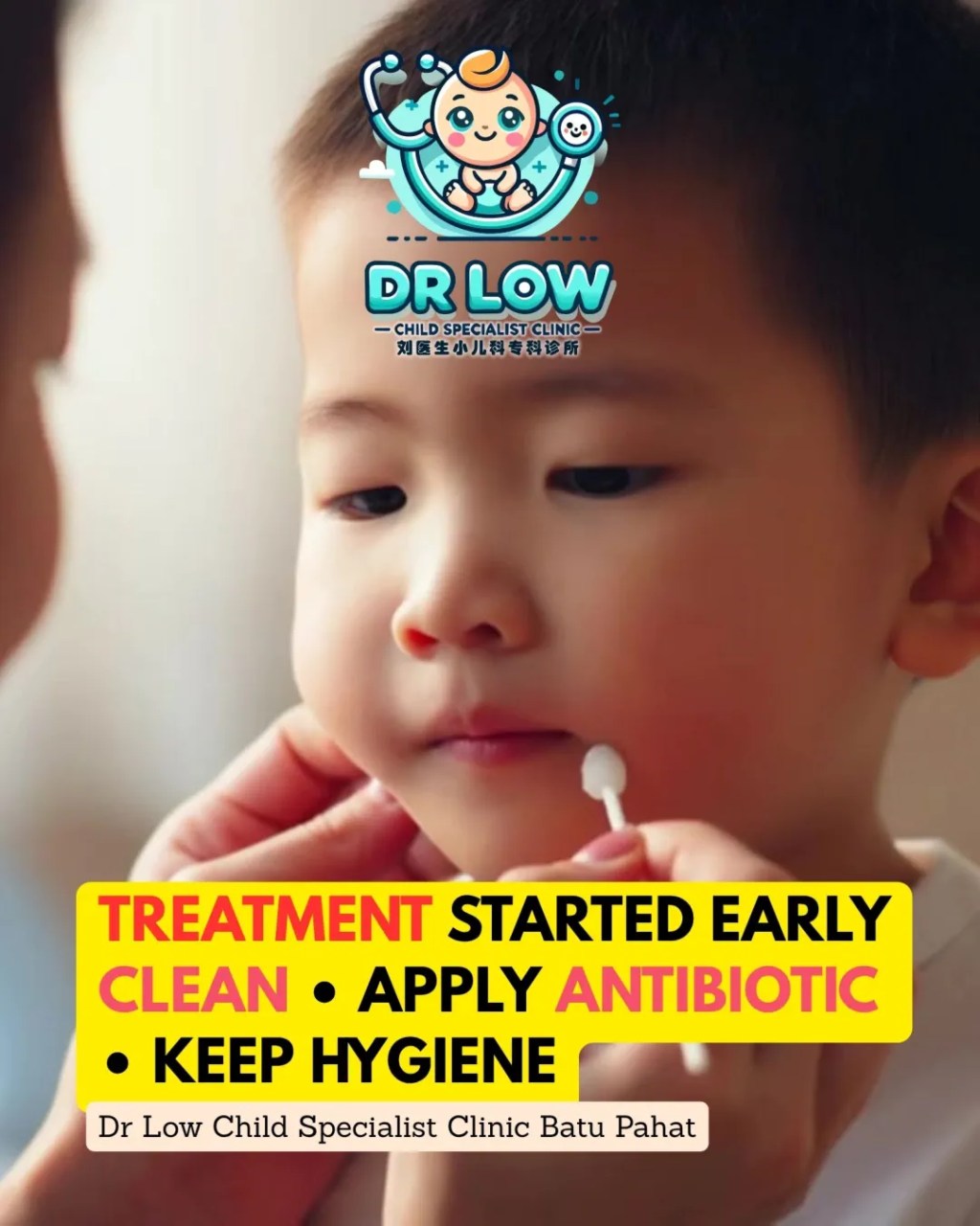 Impetigo Chin Infection in Child – Treatment and Recovery | Child Specialist Clinic Batu&nbsp;Pahat