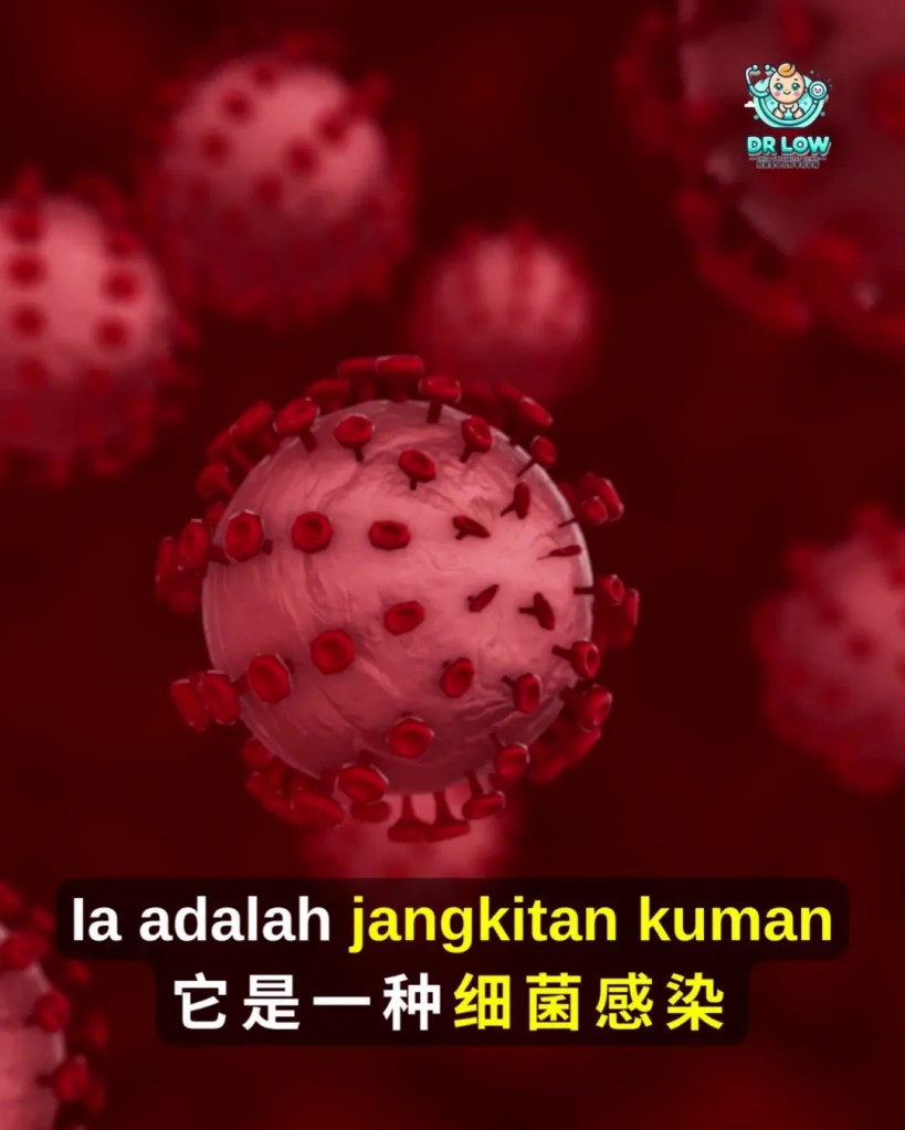 Jangkitan Meningokokal Kanak-Kanak Batu Pahat - Klinik Pakar Kanak-kanak Batu Pahat Dr Low - Dr Low Child Specialist Clinic Batu Pahat BP Johor Malaysia A07