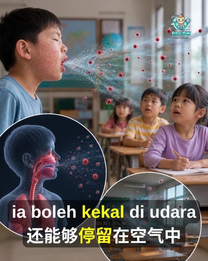 Campak Kanak-Kanak Tanda Awal - Komplikasi - Kepentingan Vaksin BP - Dr Low Child Specialist Clinic Batu Pahat Johor Malaysia A17