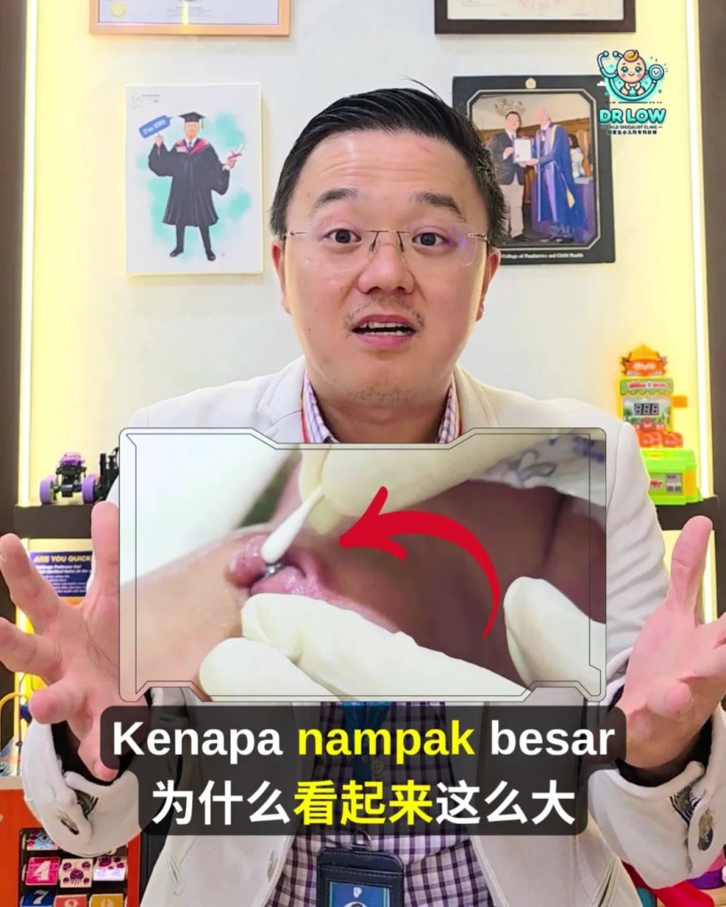 Pusat Bayi Ada Ketulan Merah Selepas Tali Pusat Gugur - Kenali Umbilical Granuloma - Dr Low Child Specialist Clinic Batu Pahat Johor Malaysia A02