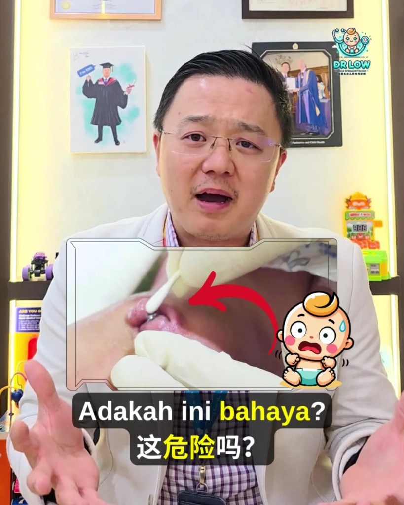 Pusat Bayi Ada Ketulan Merah Selepas Tali Pusat Gugur - Kenali Umbilical Granuloma - Dr Low Child Specialist Clinic Batu Pahat Johor Malaysia A03