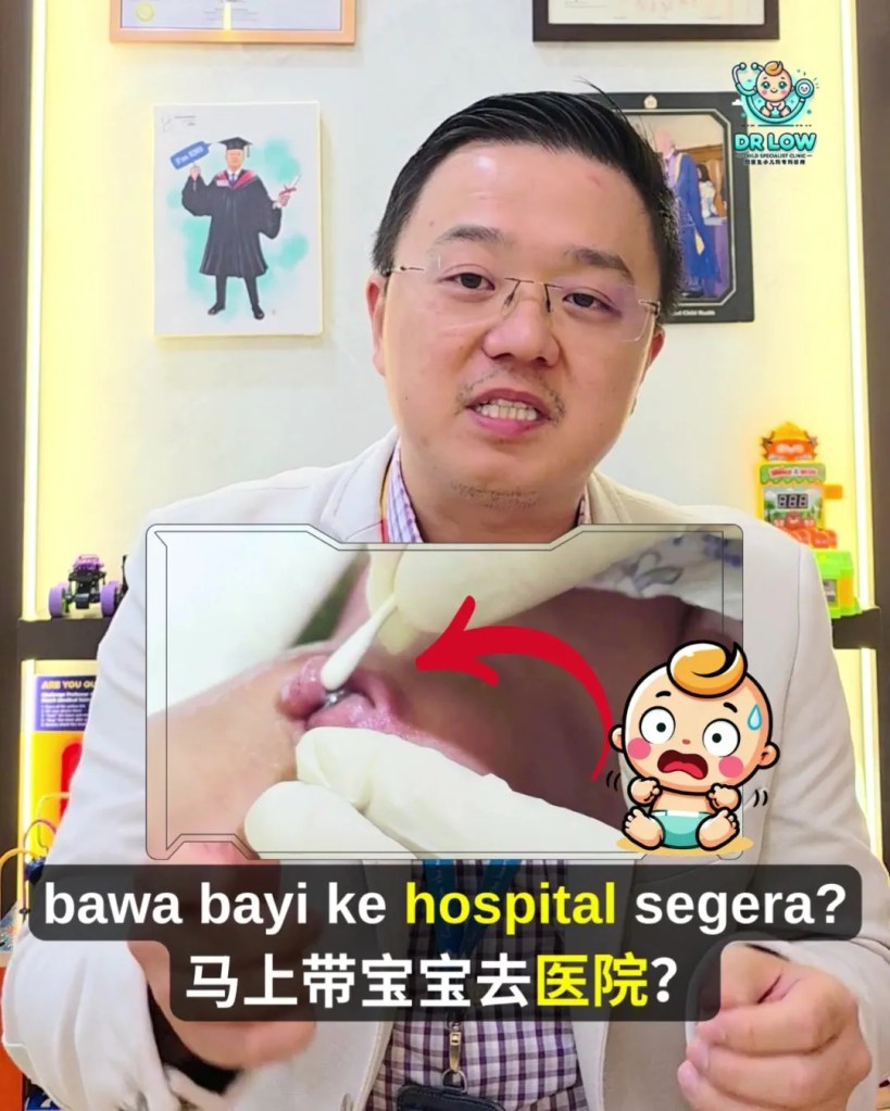 Pusat Bayi Ada Ketulan Merah Selepas Tali Pusat Gugur - Kenali Umbilical Granuloma - Dr Low Child Specialist Clinic Batu Pahat Johor Malaysia A04