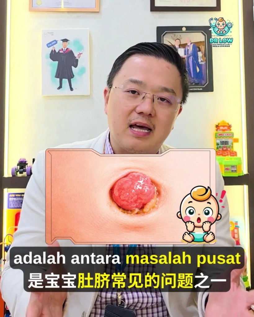 Pusat Bayi Ada Ketulan Merah Selepas Tali Pusat Gugur - Kenali Umbilical Granuloma - Dr Low Child Specialist Clinic Batu Pahat Johor Malaysia A05