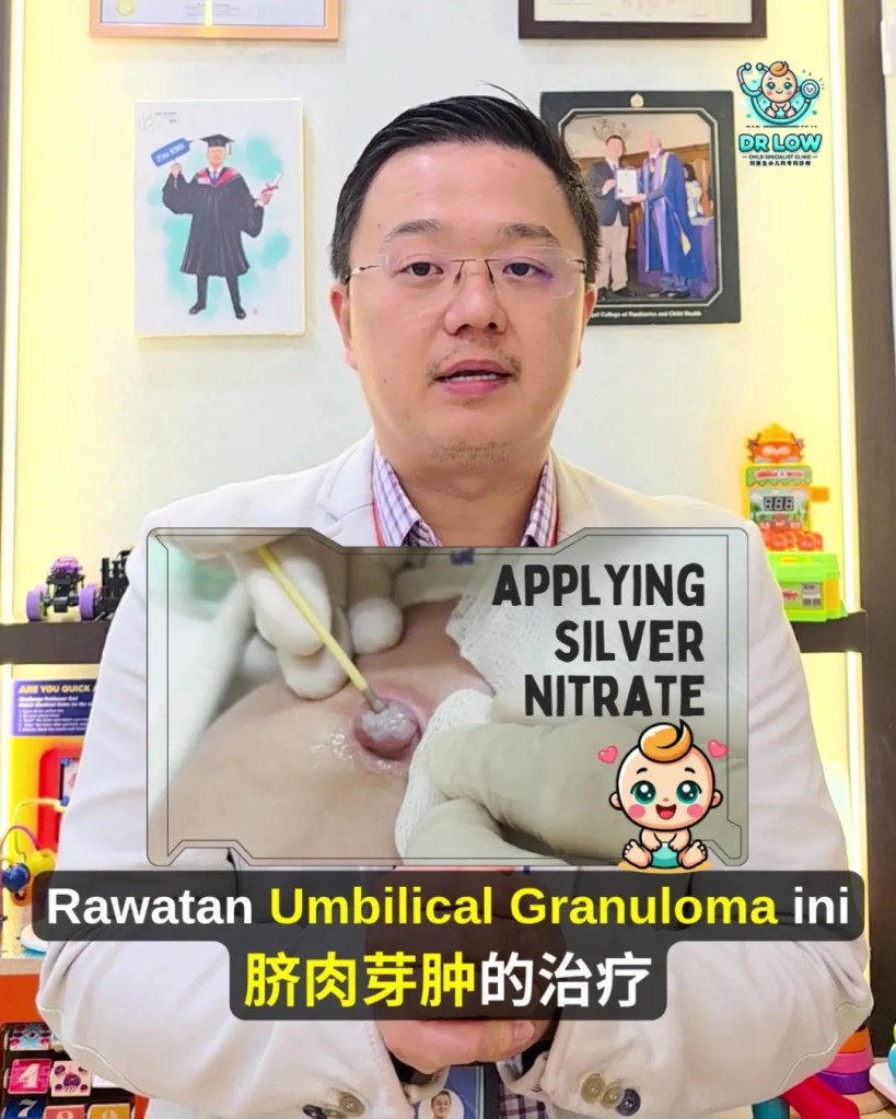 Pusat Bayi Ada Ketulan Merah Selepas Tali Pusat Gugur - Kenali Umbilical Granuloma - Dr Low Child Specialist Clinic Batu Pahat Johor Malaysia A10