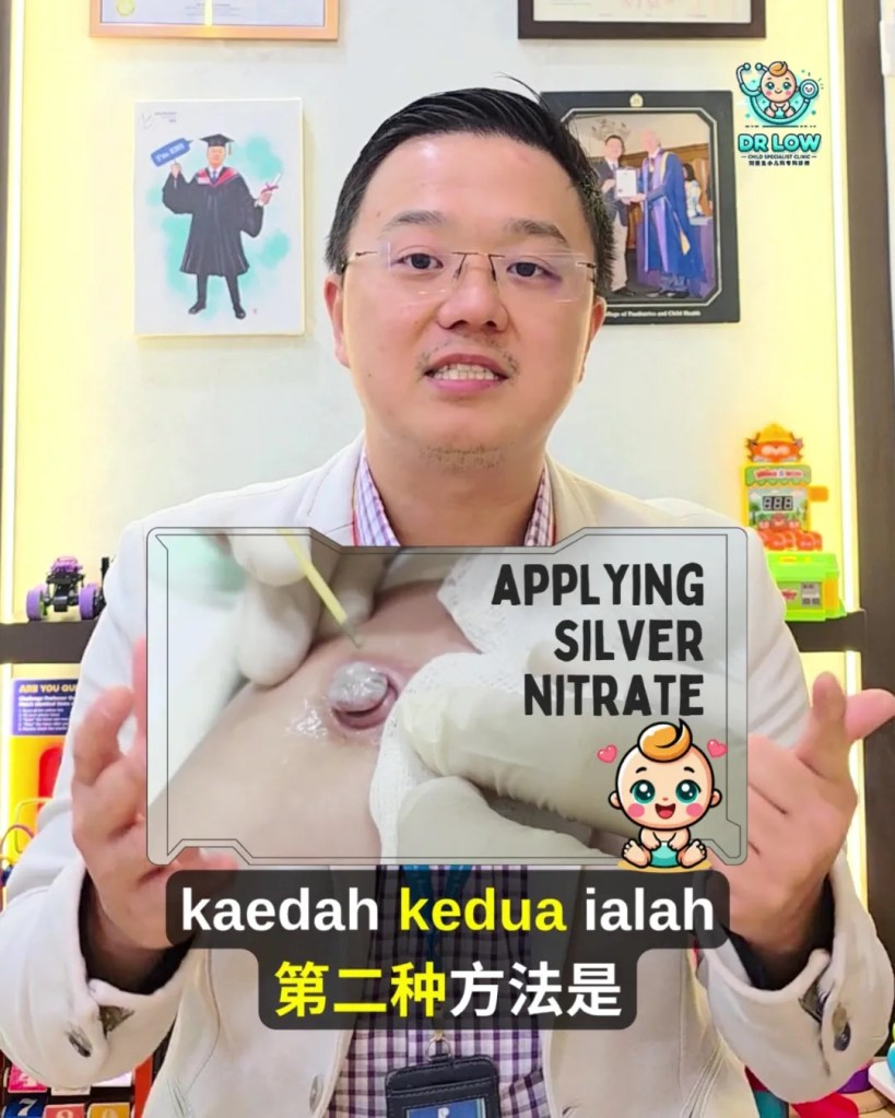 Pusat Bayi Ada Ketulan Merah Selepas Tali Pusat Gugur - Kenali Umbilical Granuloma - Dr Low Child Specialist Clinic Batu Pahat Johor Malaysia A11
