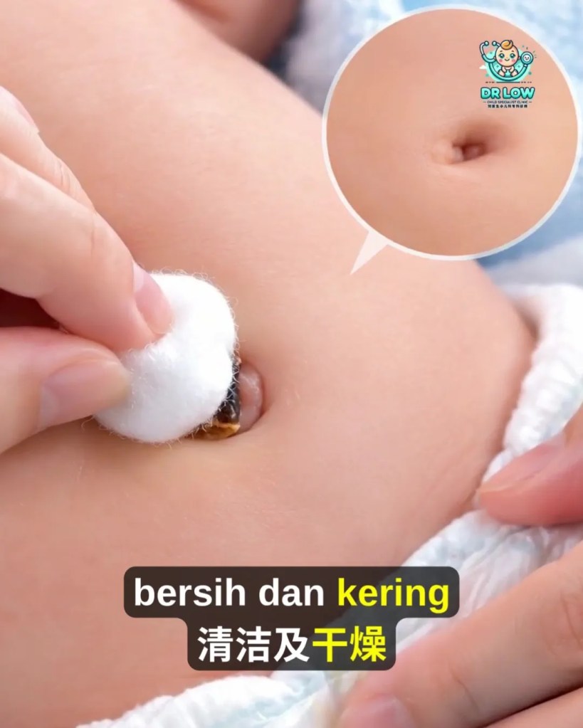 Pusat Bayi Ada Ketulan Merah Selepas Tali Pusat Gugur - Kenali Umbilical Granuloma - Dr Low Child Specialist Clinic Batu Pahat Johor Malaysia A12