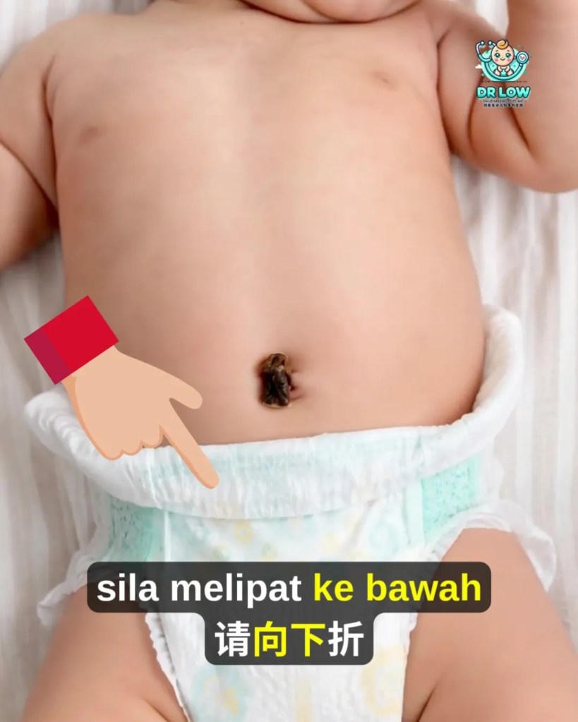 Pusat Bayi Ada Ketulan Merah Selepas Tali Pusat Gugur - Kenali Umbilical Granuloma - Dr Low Child Specialist Clinic Batu Pahat Johor Malaysia A13