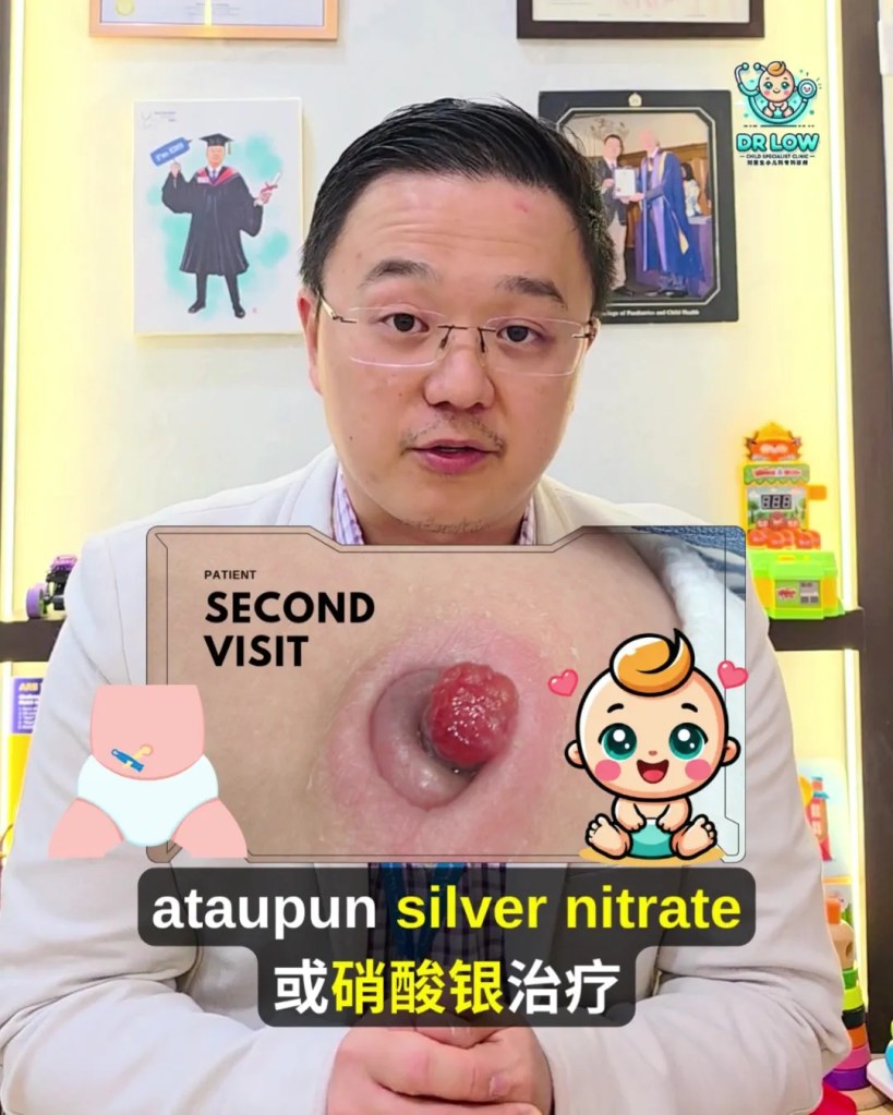Pusat Bayi Ada Ketulan Merah Selepas Tali Pusat Gugur - Kenali Umbilical Granuloma - Dr Low Child Specialist Clinic Batu Pahat Johor Malaysia A18