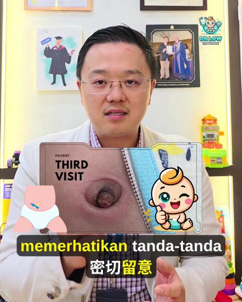 Pusat Bayi Ada Ketulan Merah Selepas Tali Pusat Gugur - Kenali Umbilical Granuloma - Dr Low Child Specialist Clinic Batu Pahat Johor Malaysia A19