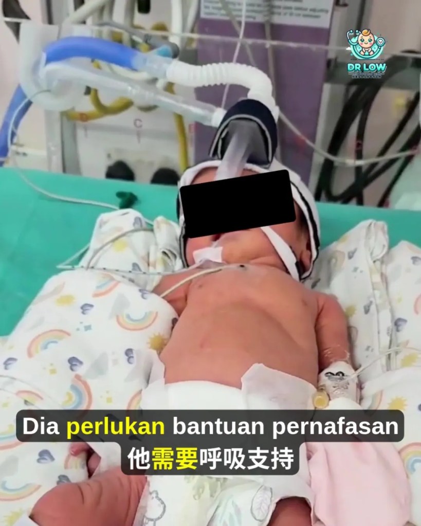 RSV Pada Bayi dan Kanak-Kanak BP - Tanda Awal, Gejala Berbahaya, Rawatan dan Cara Pencegahan - Dr Low Child Specialist Clinic Batu Pahat Johor A10