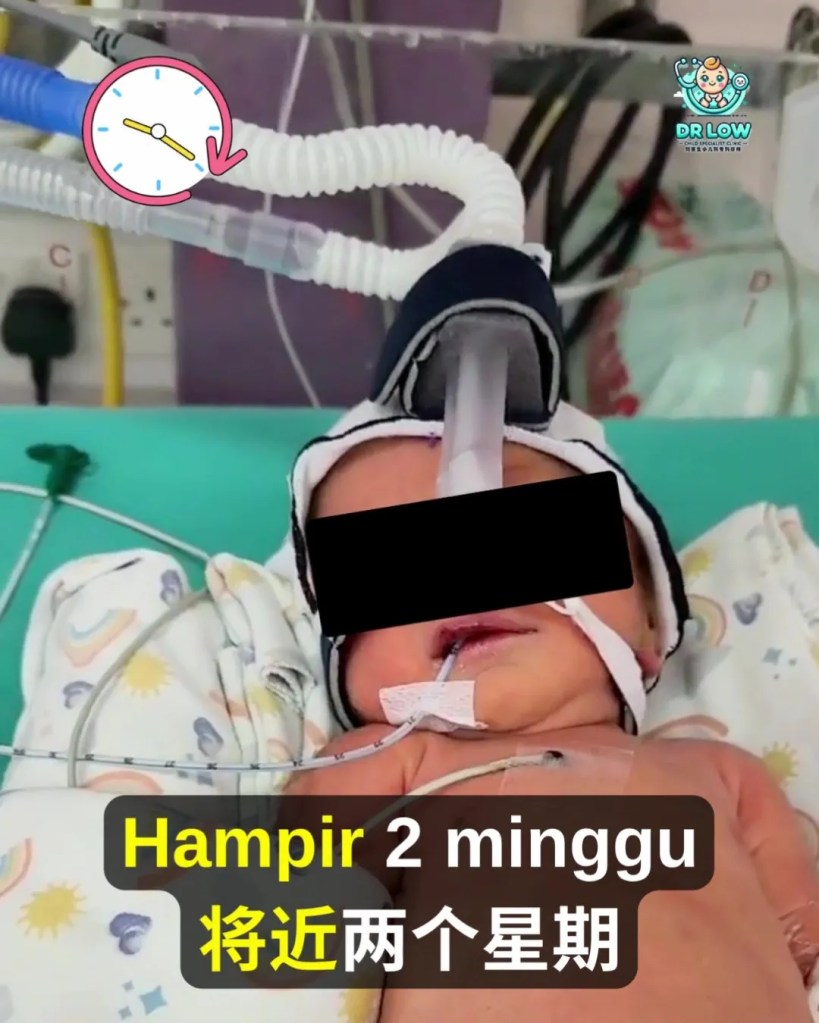 RSV Pada Bayi dan Kanak-Kanak BP - Tanda Awal, Gejala Berbahaya, Rawatan dan Cara Pencegahan - Dr Low Child Specialist Clinic Batu Pahat Johor A11