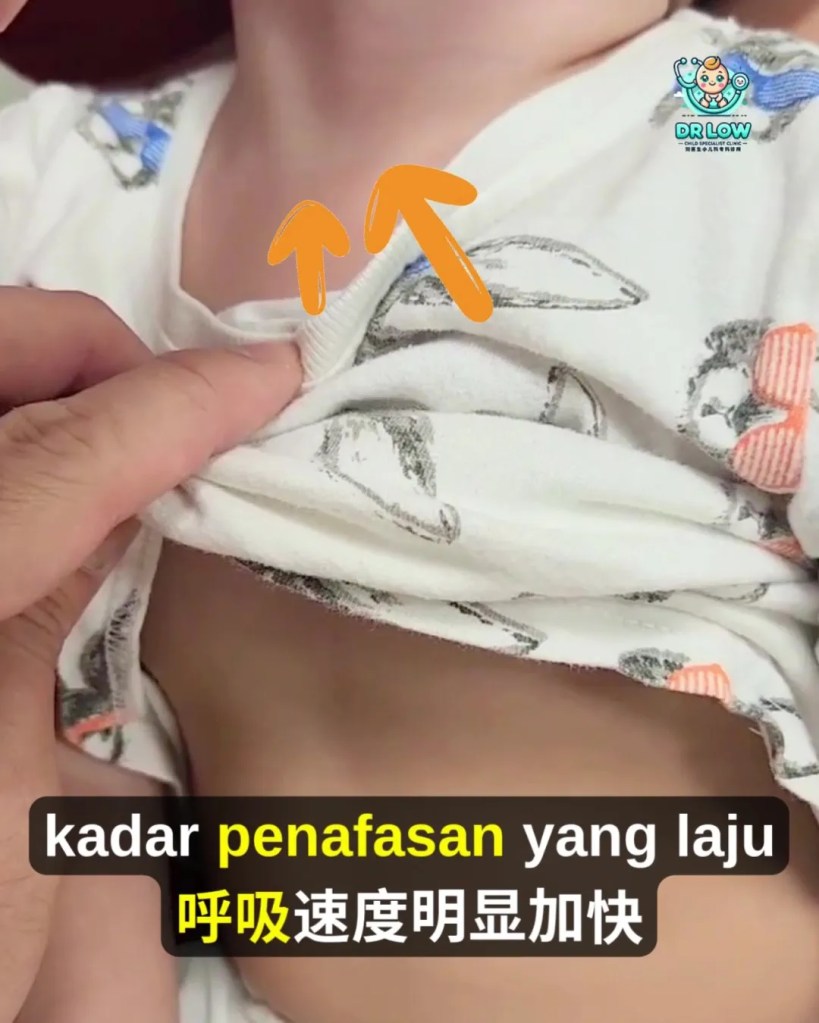 RSV Pada Bayi dan Kanak-Kanak BP - Tanda Awal, Gejala Berbahaya, Rawatan dan Cara Pencegahan - Dr Low Child Specialist Clinic Batu Pahat Johor A19